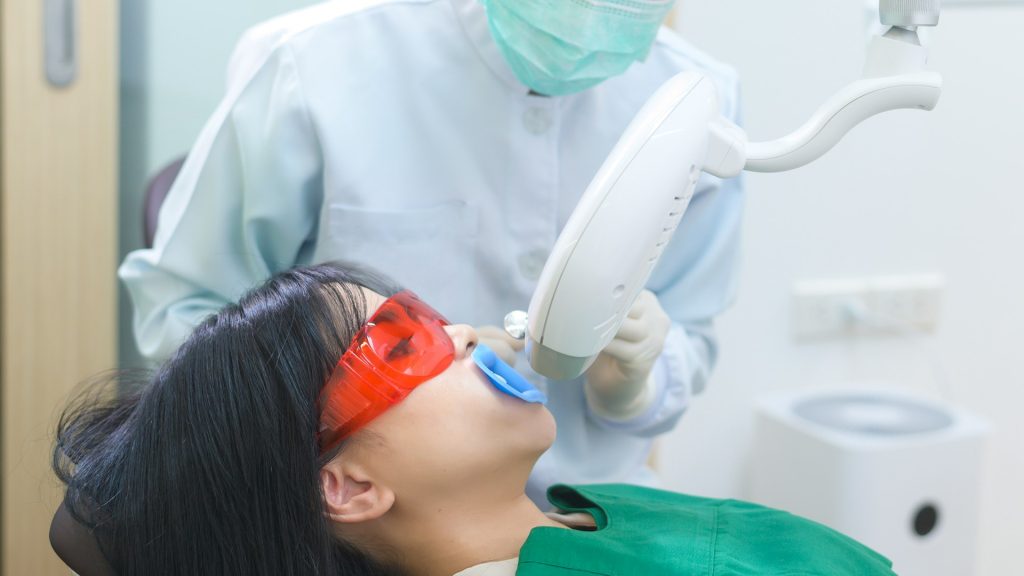 Blanchiment Dentaire